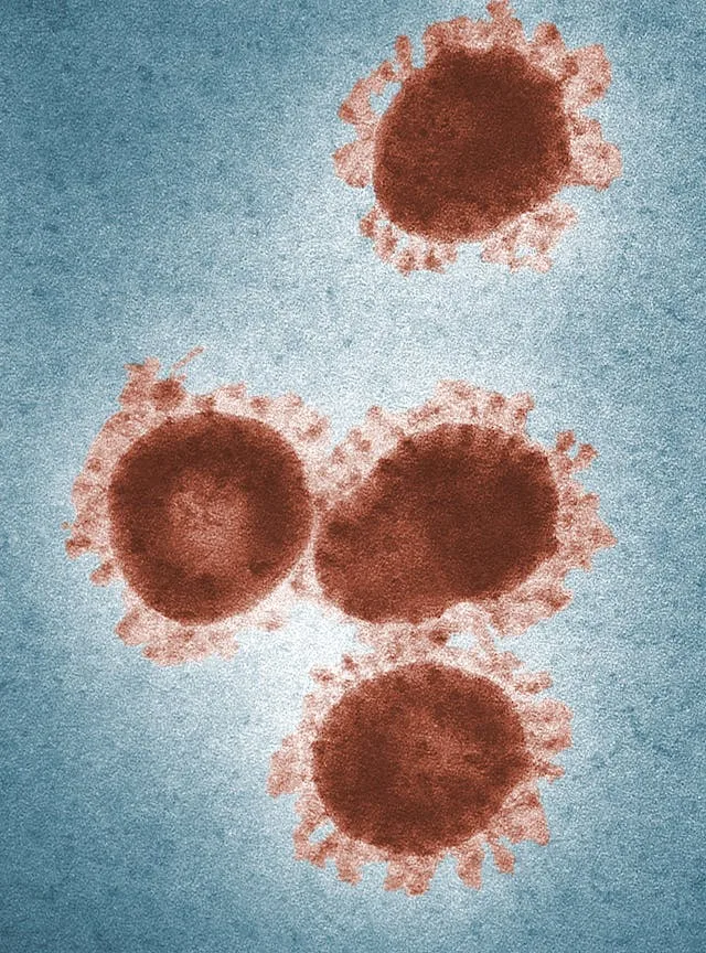 Microscopic Aspergillus fungus spreading due to global warming in 2025