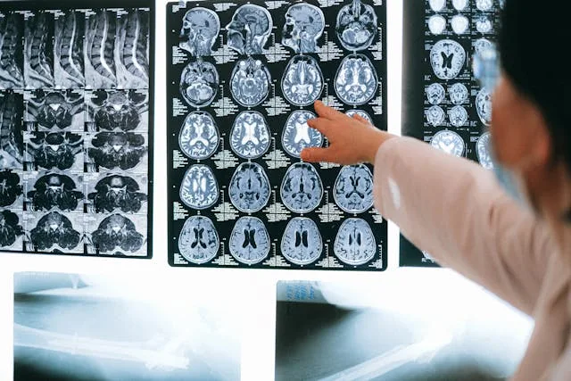 Mind Blanking and Brain Activity Drop